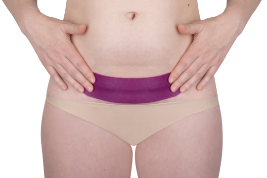 Scarban C Section recovery kit