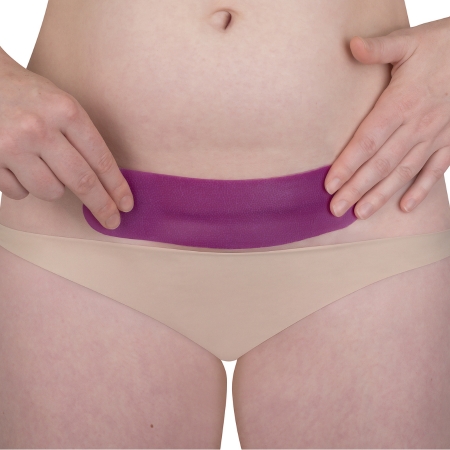 Scarban C-section